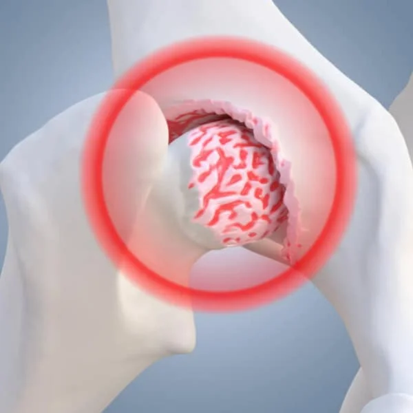 Canine arthritis and joint inflammation